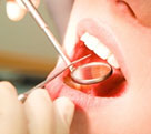DENTYSTA